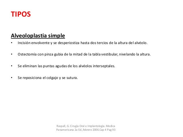 alveoloplastia simple